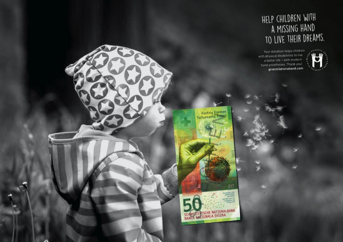 Give Children a Hand: Help children with a missing hand, 3