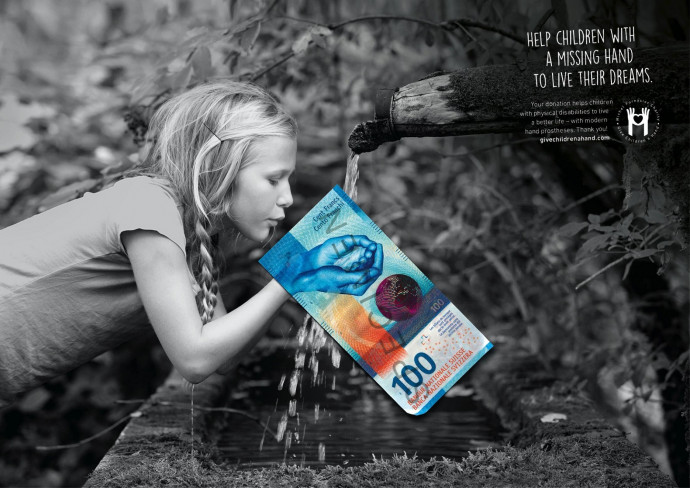 Give Children a Hand: Help children with a missing hand, 4