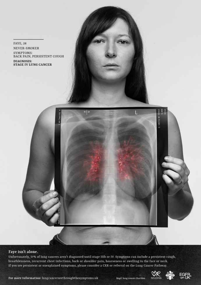 ALK Positive UK / Ruth Strauss Foundation / EGFR Positive UK: See Through The Symptoms, 1