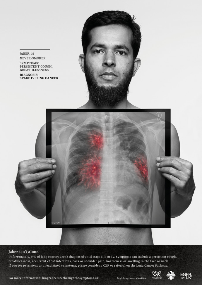 ALK Positive UK / Ruth Strauss Foundation / EGFR Positive UK: See Through The Symptoms, 2