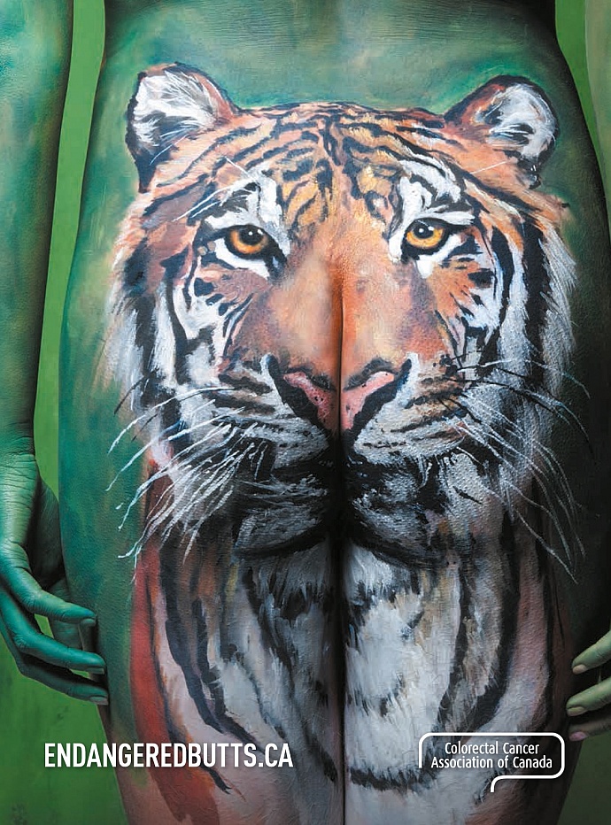 Colorectal Cancer Association of Canada: Tiger